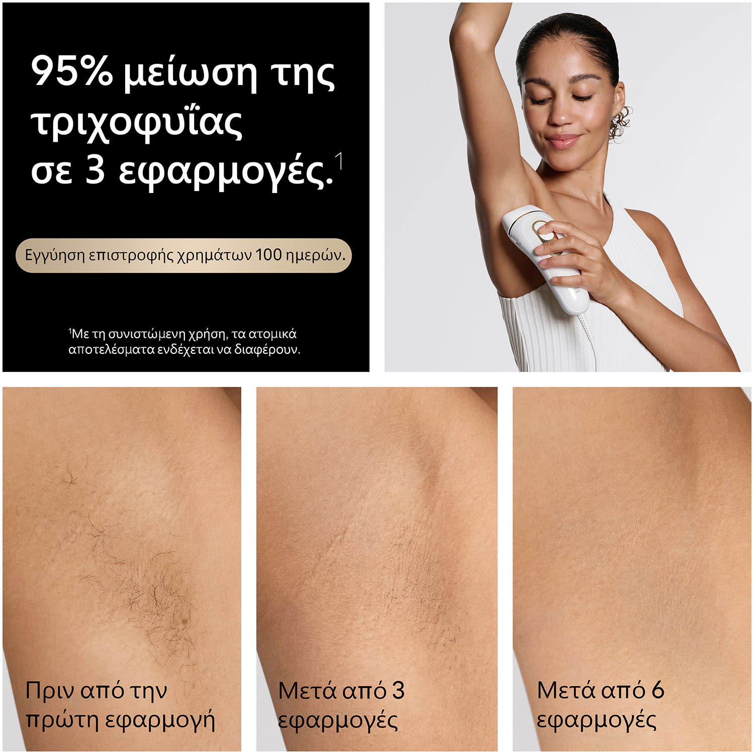 Κάνε κλικ για να δεις την εικόνα 6 του Braun Αποτριχωτική Μηχανή PL5210