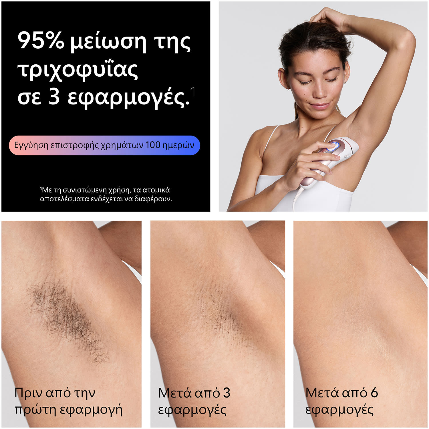 Εικόνα 9 του Braun Αποτριχωτική Μηχανή PL7321