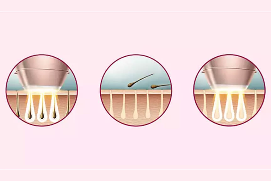 4103181_TILE2_b69fa9