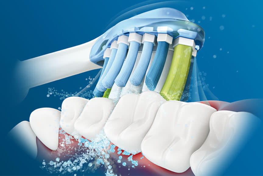 4763327_TILE1_015383