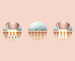 Philips Αποτριχωτική Mηχανή