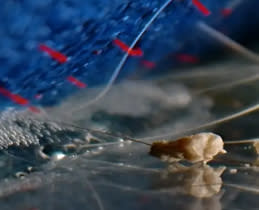 Τέλος στις τρίχες! 